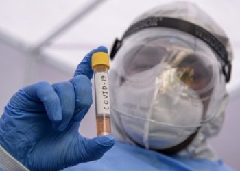 Mundo ultrapassa marca de 400 mil recuperados da COVID-19, diz universidade