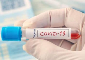 Coronavírus: Atualização do Boletim Epidemiológico desta sexta, 05 de junho