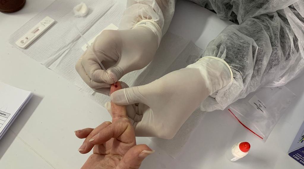 Secretaria de Saúde inicia testagem de Covid-19 em todos os servidores do setor