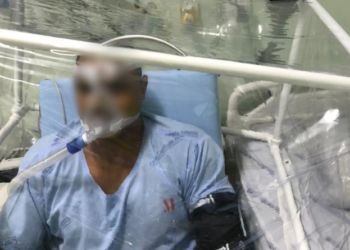 Hospital de Campanha de Poços recebe cabines de Ventilação Não Invasivas produzidas pela UNIFAL-MG