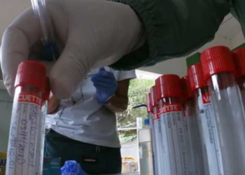 Governo de Minas anuncia desenvolvimento de soro contra covid-19