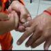Corpo de Bombeiros retira anel preso em dedo de homem em Poços de Caldas