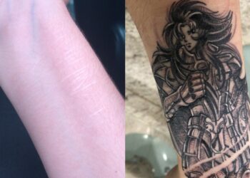 Projeto resgata autoestima de mulheres trocando cicatrizes por tatuagens