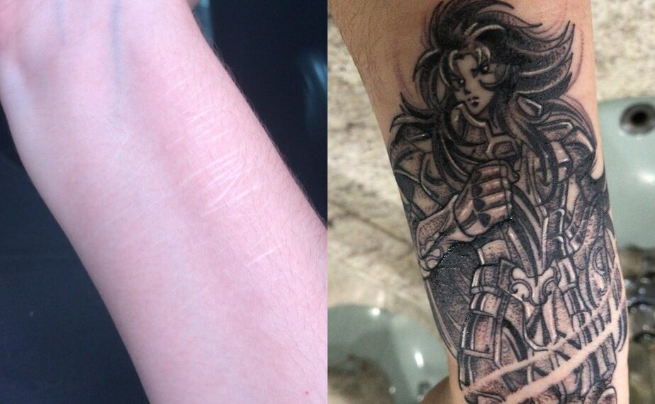 Projeto resgata autoestima de mulheres trocando cicatrizes por tatuagens