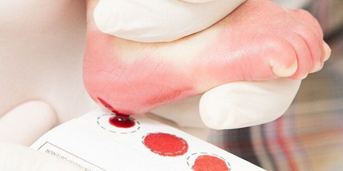 BRASIL | Sancionada lei que amplia o teste do pezinho