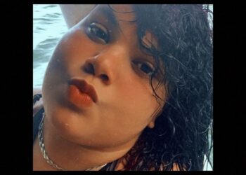 POÇOS DE CALDAS | Jovem com ceratocone pede ajuda para pagar cirurgia