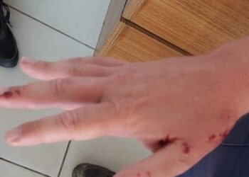 Funcionário do DME é atacado por cão