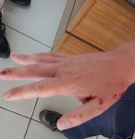 Funcionário do DME é atacado por cão