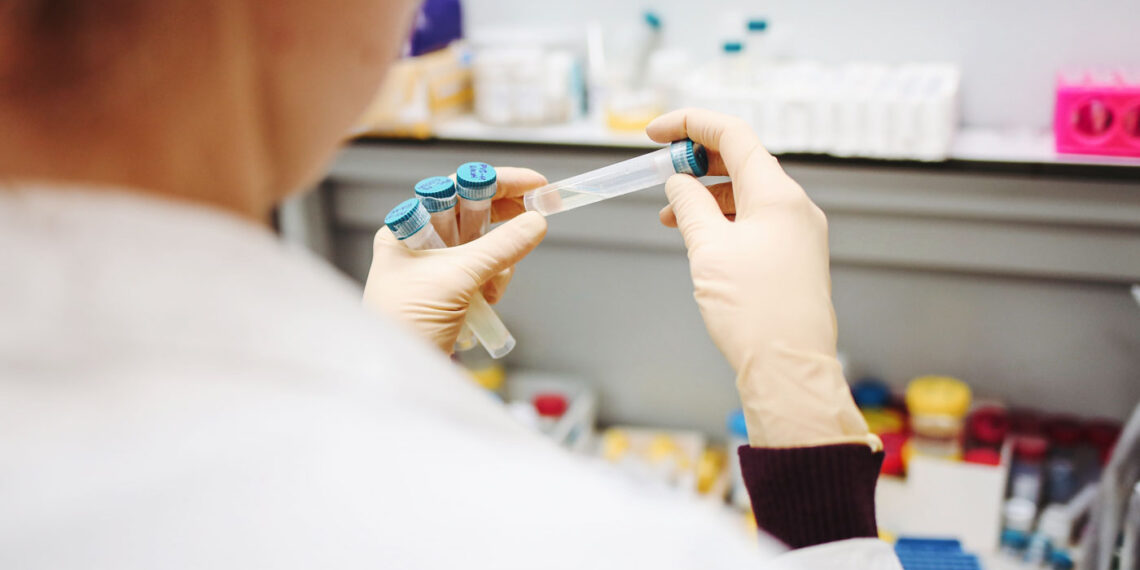 Poços de Caldas segue sem registro de novos casos pela COVID-19