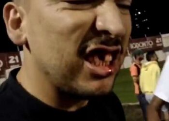 Massagista joga garrafa e quebra dente de torcedor em Poços de Caldas; veja