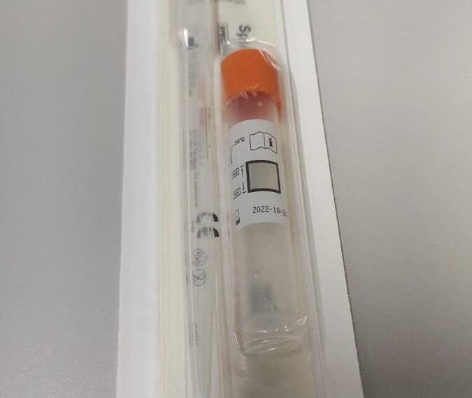 Poços de Caldas participa de projeto piloto para diagnóstico de clamídia e gonorreia