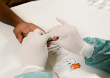 Poços de Caldas registra aumento de casos de HIV em 2021