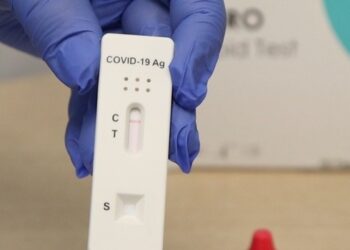 Minas Gerais distribui mais de 1 milhão de testes rápidos de covid-19