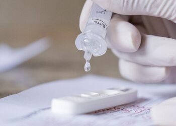 Anvisa aprova segundo autoteste para Covid-19