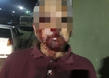 Briga generalizada termina com idoso ferido na Zona Sul de Poços de Caldas