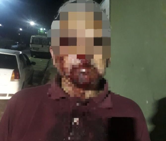 Briga generalizada termina com idoso ferido na Zona Sul de Poços de Caldas