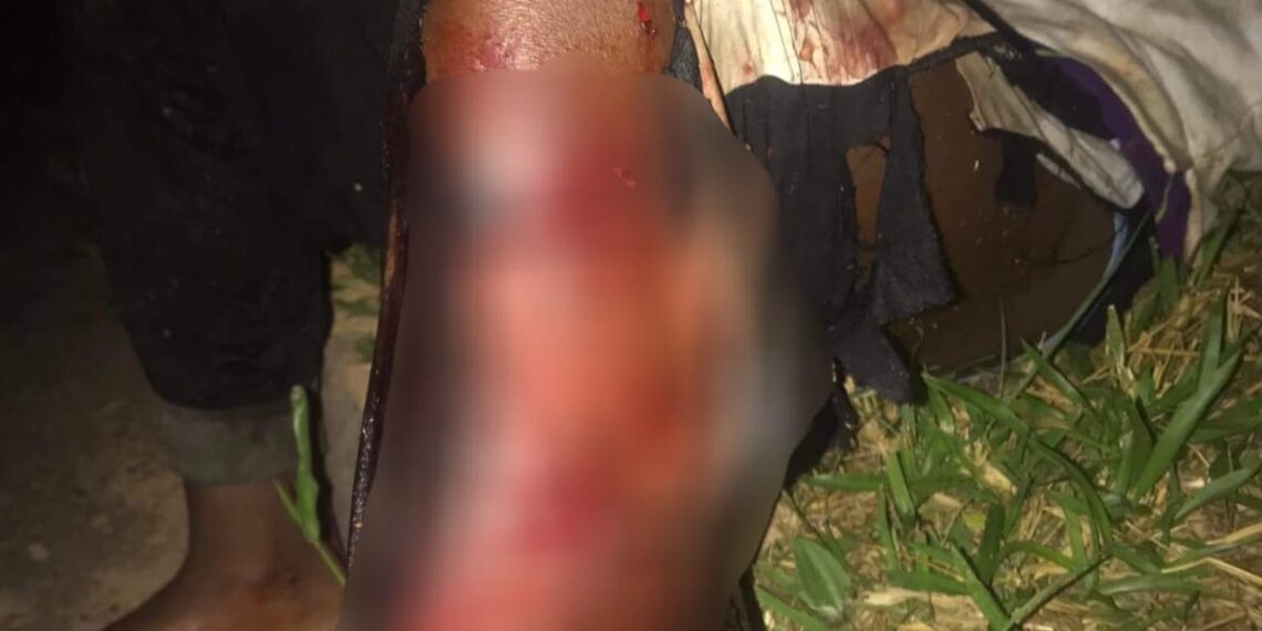 Homem é atacado por dois pitbulls na Zona Sul de Poços de Caldas