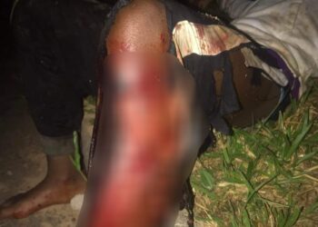 Homem é atacado por dois pitbulls na Zona Sul de Poços de Caldas