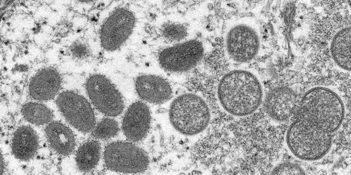 3° caso de varíola dos macacos é registrado no Brasil