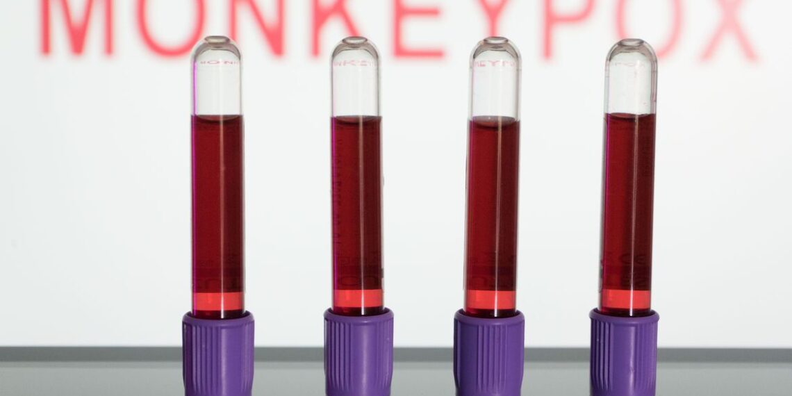 Varíola dos macacos: entenda a transmissão, os sintomas e a vacina