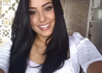 Jovem que sofreu queimaduras em 30% do corpo segue internada em Poços