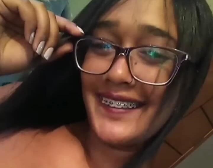 Liminar impede transferência de jovem que teve corpo queimado para hospital de BH