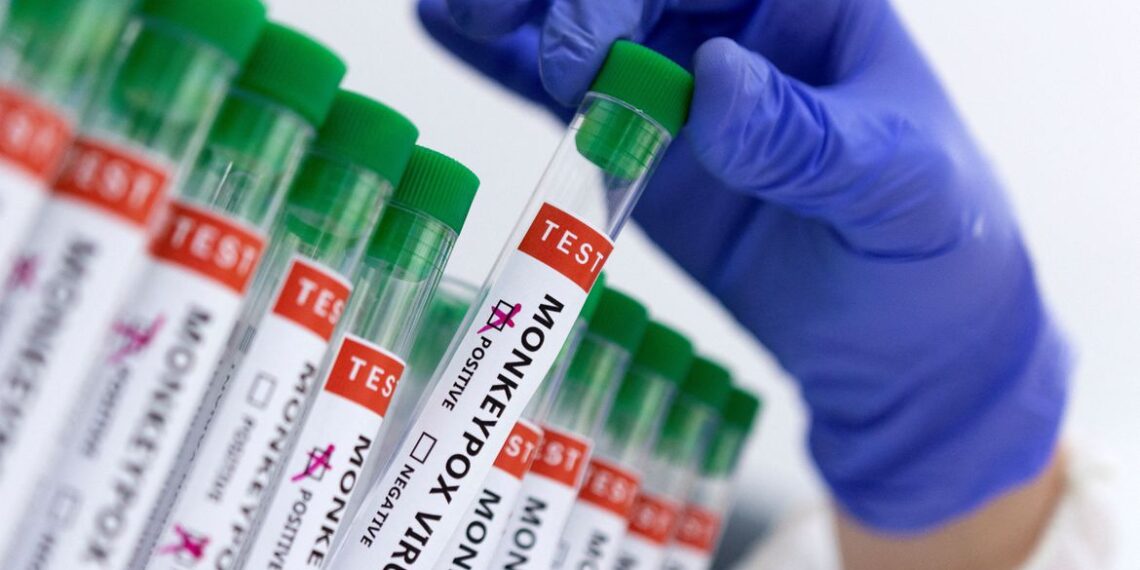 Andradas confirma 3º caso de varíola dos macacos