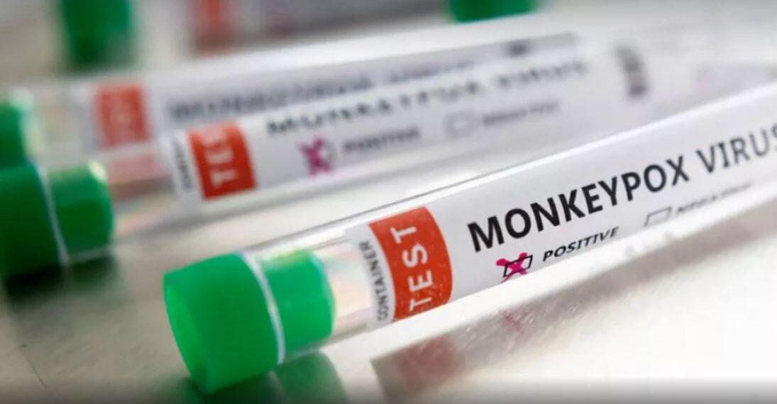 Andradas confirma primeiro caso de varíola dos macacos