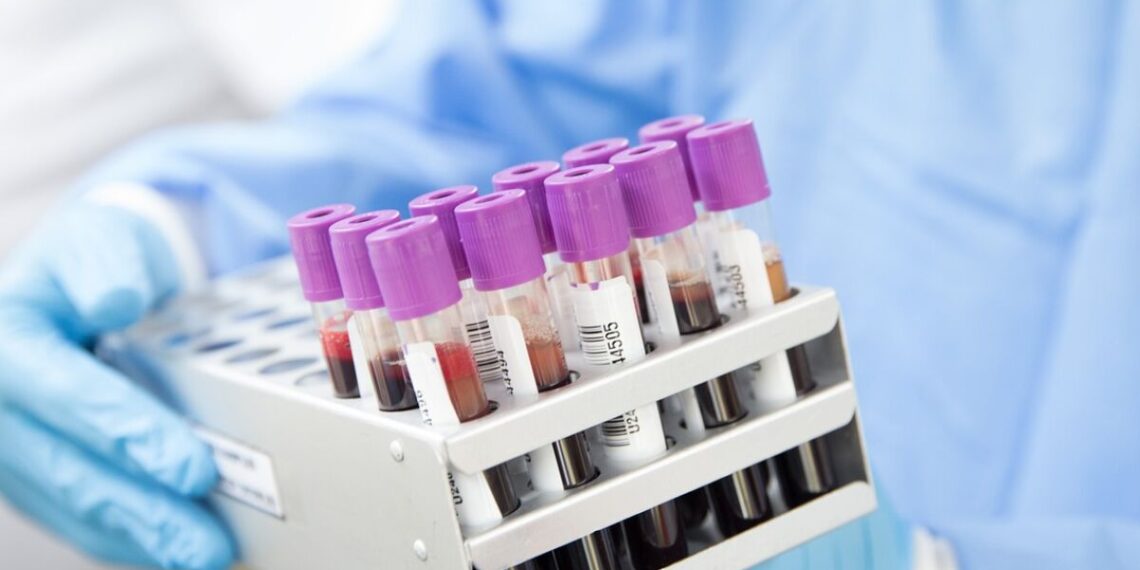 Varíola dos macacos: 14 casos já foram confirmados no Sul de Minas