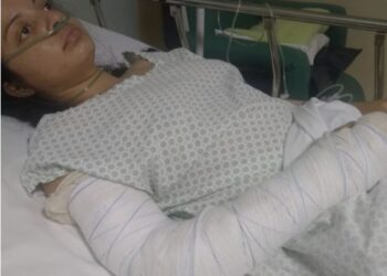 Jovem que teve bolsa furtada após acidente pede ajuda em Poços de Caldas