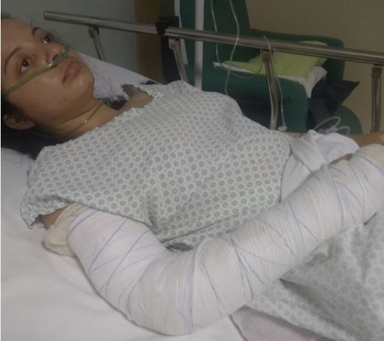 Jovem que teve bolsa furtada após acidente pede ajuda em Poços de Caldas