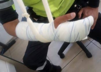 Agente de trânsito sofre fratura após ser agredido por familiares de condutor inabilitado em Poços de Caldas