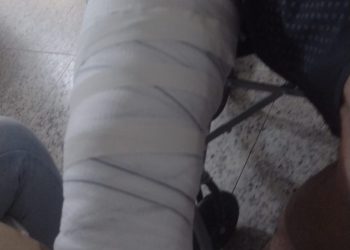 Policiais militares são acusados de causar fratura em serralheiro durante abordagem em Poços de Caldas