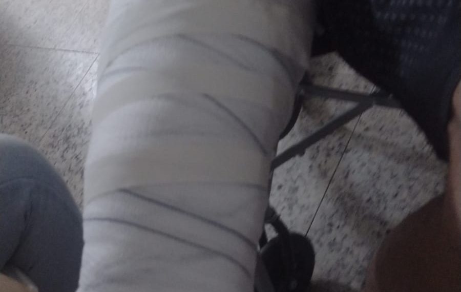 Policiais militares são acusados de causar fratura em serralheiro durante abordagem em Poços de Caldas