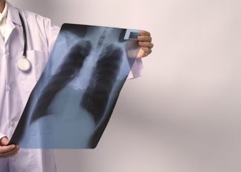 Tuberculose tem cura e tratamento garantido pelo SUS