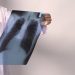 Tuberculose tem cura e tratamento garantido pelo SUS