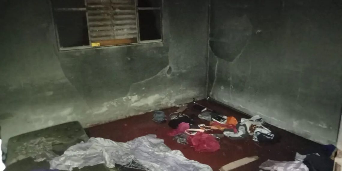 Mulher sofre queimaduras em 80% do corpo após incêndio causado pelo companheiro
