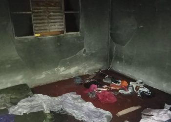 Mulher sofre queimaduras em 80% do corpo após incêndio causado pelo companheiro