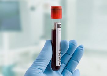 Endocrinologista da Unimed Poços alerta sobre os riscos do colesterol elevado