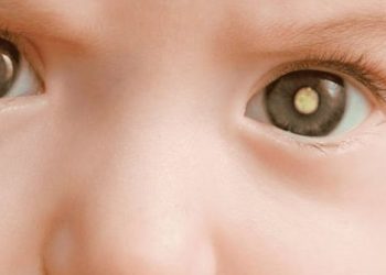 De Olho nos Olhinhos: Poços integra programação nacional contra retinoblastoma