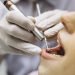Dentista terá que devolver quase R$ 30 mil por falha em procedimento em cliente no Sul de Minas