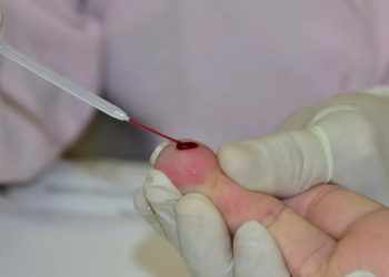 Saúde faz alerta sobre aumento de casos de sífilis em Poços de Caldas