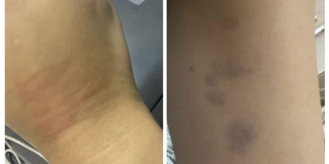 Mulher acusa policiais de agressão e tortura psicológica após prisão por desacato em Poços de Caldas