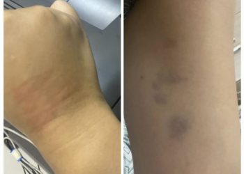 Mulher acusa policiais de agressão e tortura psicológica após prisão por desacato em Poços de Caldas