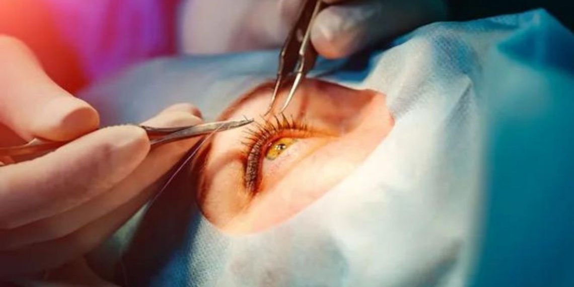 Médicos alertam para riscos de cirurgia de mudança da cor dos olhos