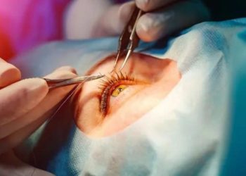 Médicos alertam para riscos de cirurgia de mudança da cor dos olhos