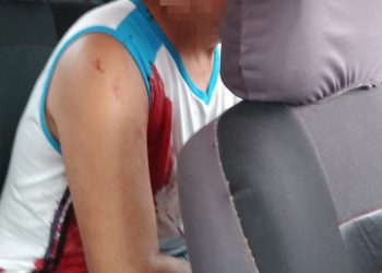 Morador é vítima de bala perdida durante confronto entre PM e suspeito