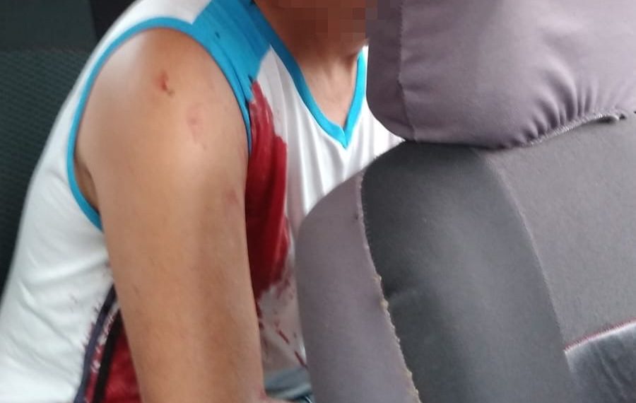 Morador é vítima de bala perdida durante confronto entre PM e suspeito