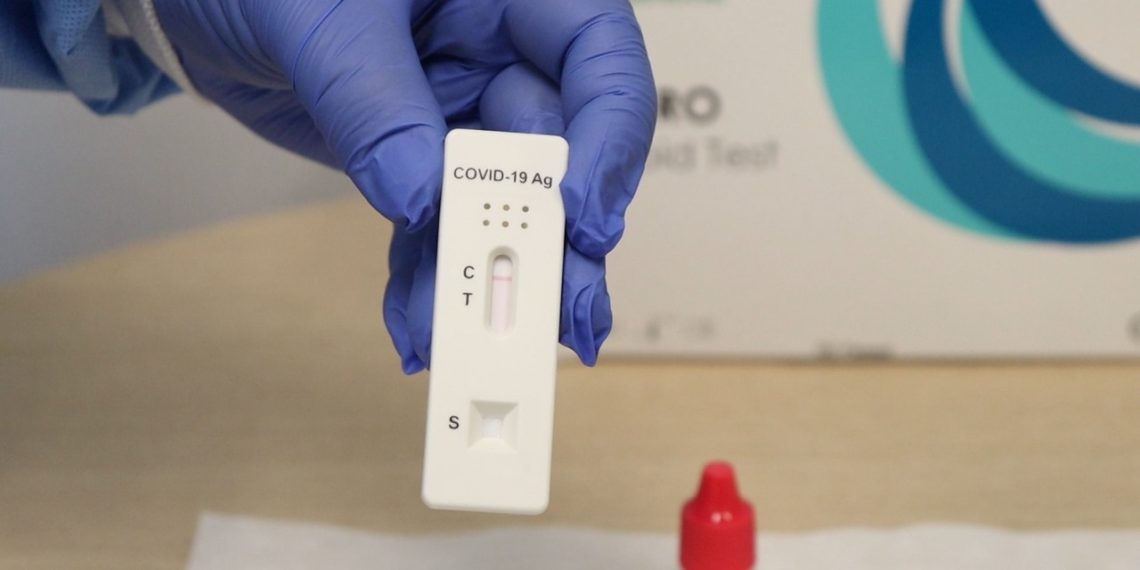 Secretaria de Saúde informa que testes de COVID-19 se esgotaram em Poços de Caldas