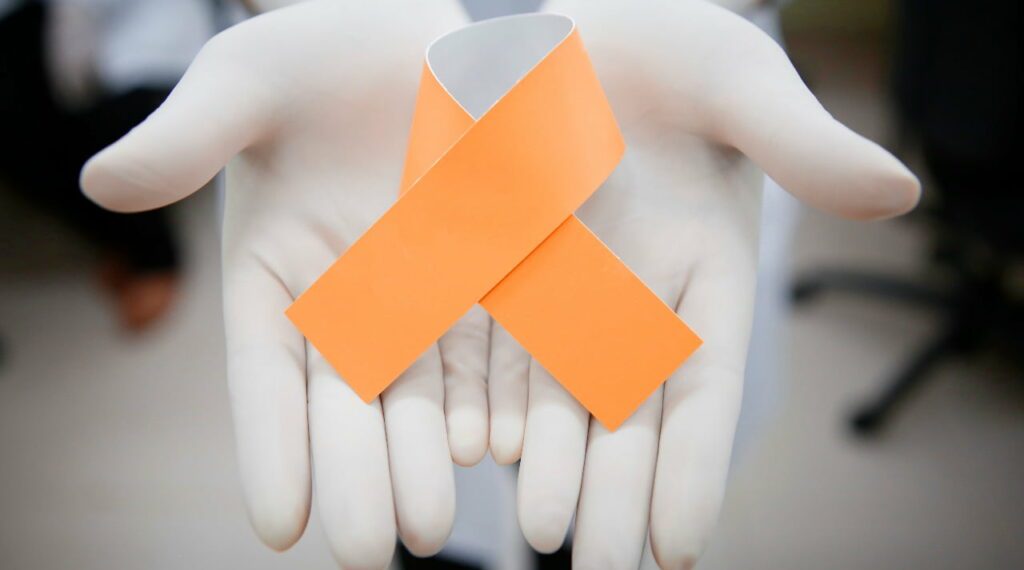 Cristo de Poços de Caldas fica Laranja pela Luta contra Queimaduras